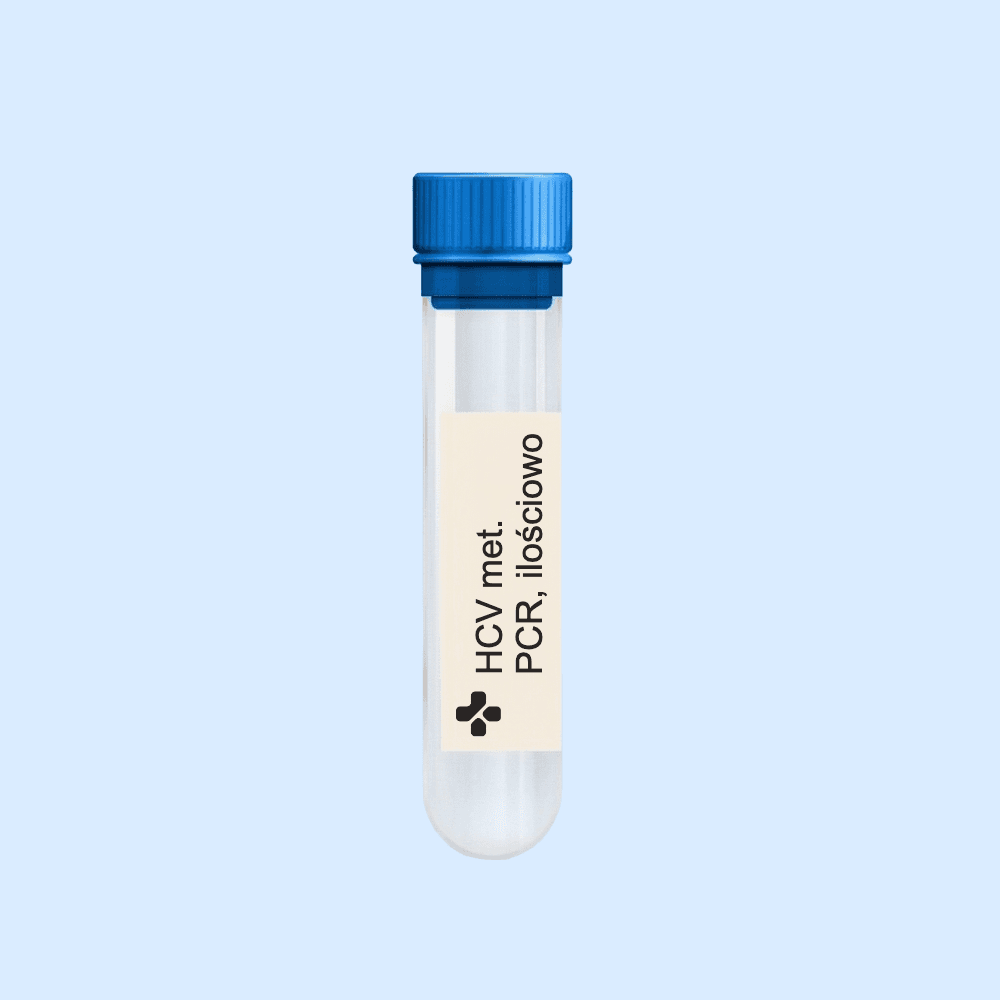 HCV met. PCR, ilościowo