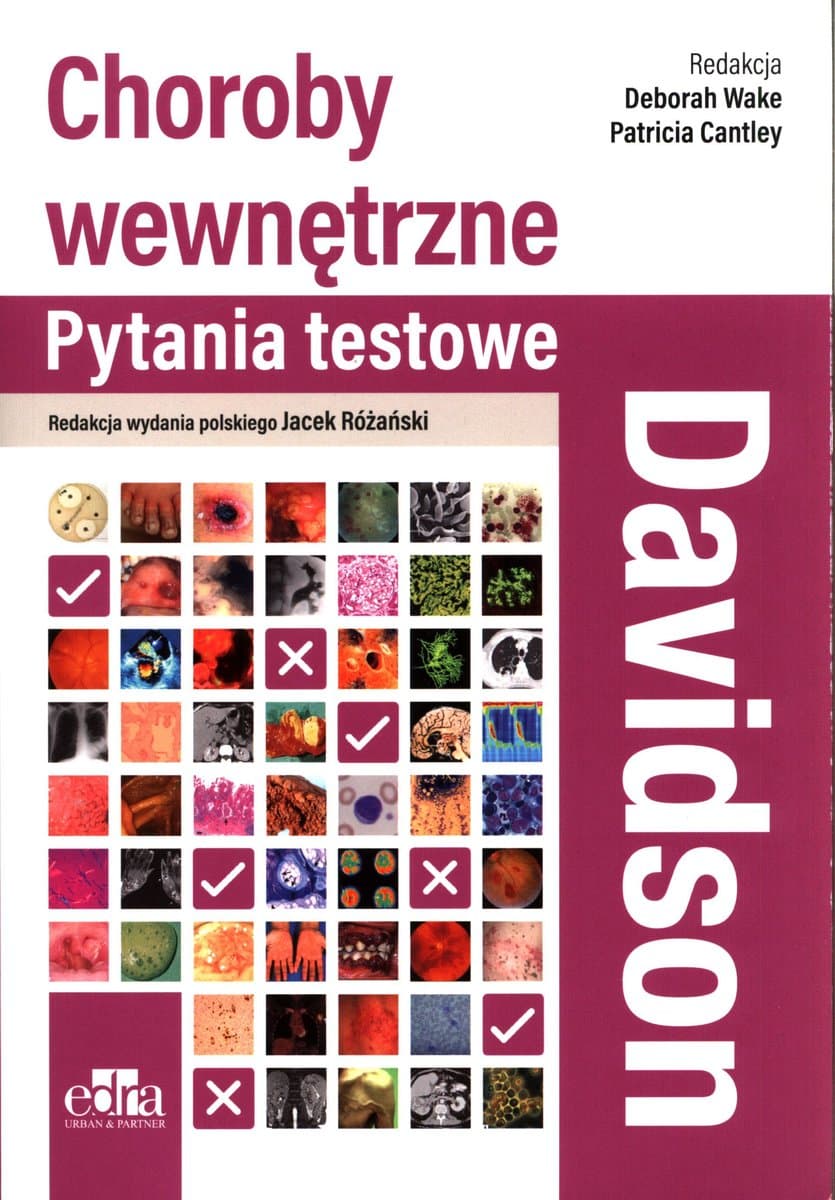 Davidson Choroby wewnętrzne. Pytania testowe