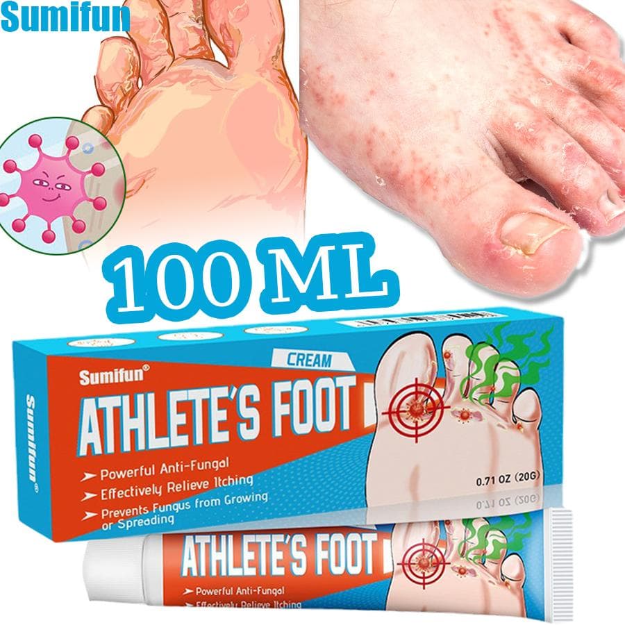Sumifun 20/40/100 ML Krem Łagodzący Swędzenie Stóp Redukuje Zapach Stóp Pocenie Się Złuszczanie Rozwiązuje Dyskomfort Stopy Atletycznej Maść